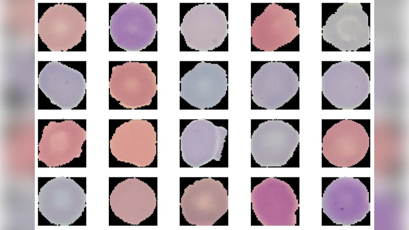 딥 컨볼루션 신경망을 활용한 적혈구 말라리아 기생충 검출 성능 향상