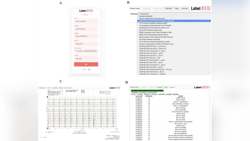 분산 ECG 라벨링을 위한 웹 기반 도구 LabelECG