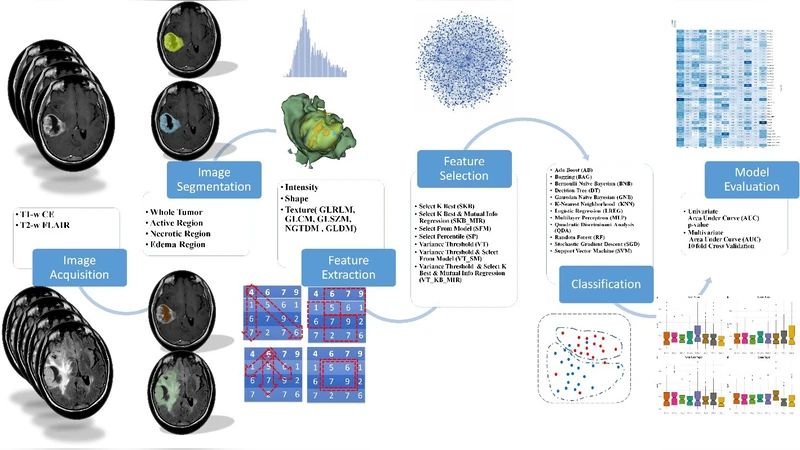 MRI 방사선유전체를 이용한 GBM MGMT 메틸화 상태 비침습 예측
