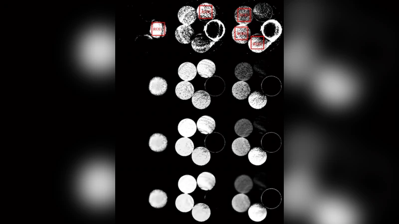 딕셔너리 학습 기반 이미지 도메인 물질 분해를 활용한 스펙트럼 CT