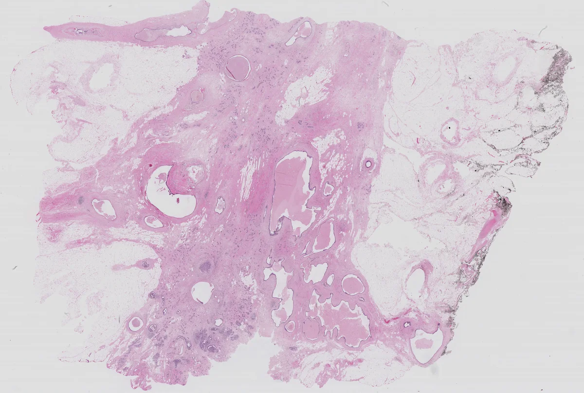 전역·국소 정보를 동시에 잡는 이중 입력 주의 메커니즘 기반 WSI 분할 네트워크