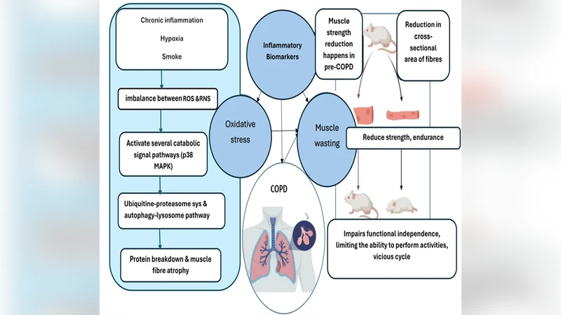 COPD 근육예측을 위한 기하·양자 커널 혁신