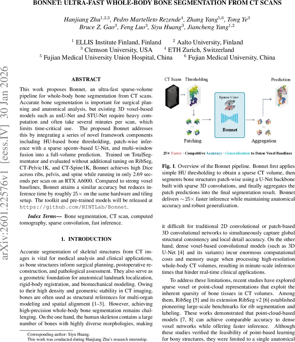 초고속 전신 뼈 분할 Bonnet