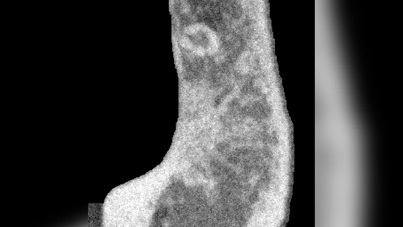 하이브리드 어텐션 잔차 U‑Net 기반 저선량 CBCT 엣지 보존 노이즈 제거