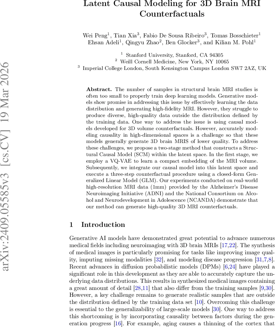 Kerr‑Bertotti‑Robinson 시공간에서 구형 궤도에 작용하는 자기장 효과와 M87 제트 전진 제한