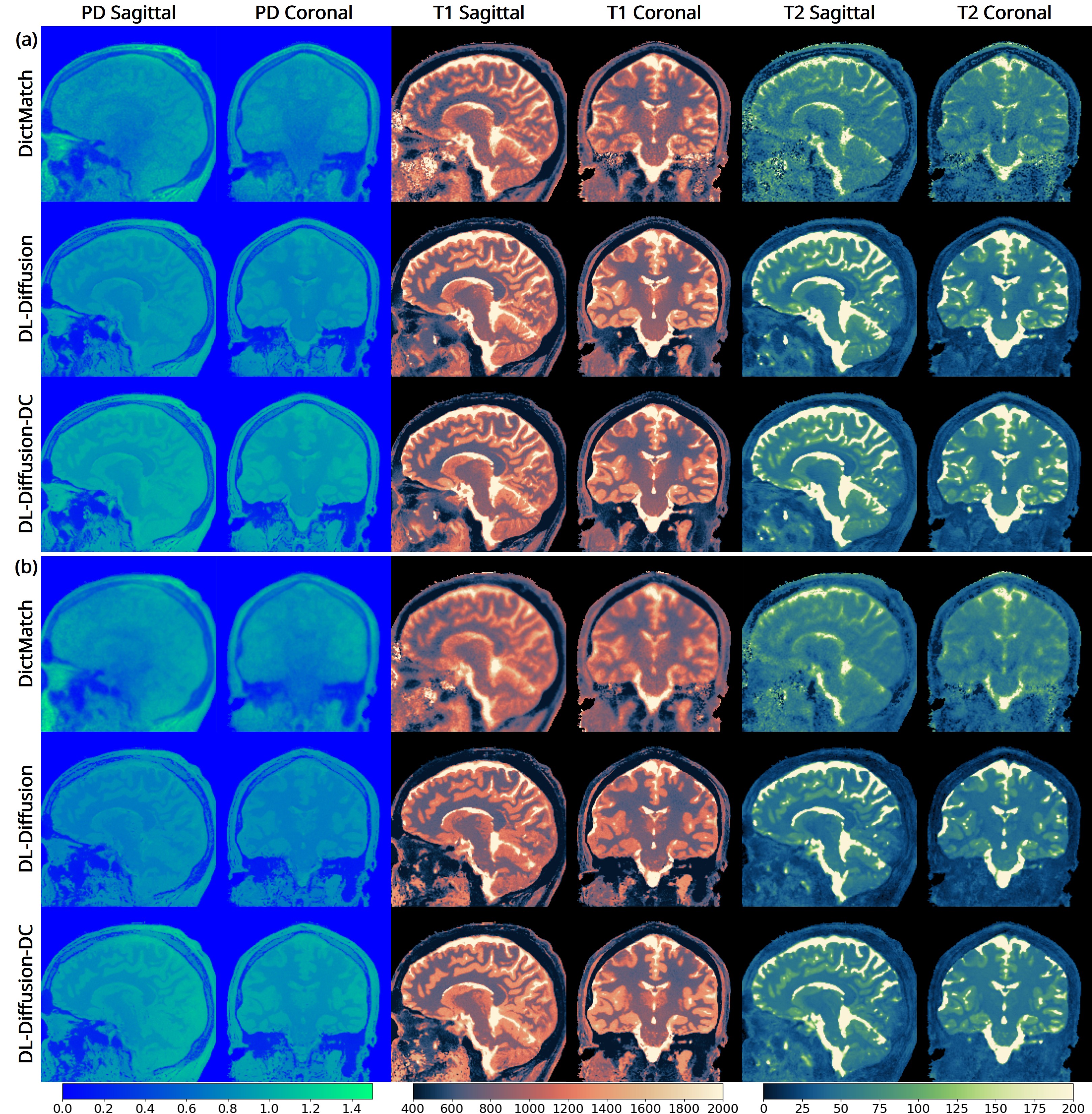q3-MuPa  Silent Scans with Physics-Infused Diffusion Models