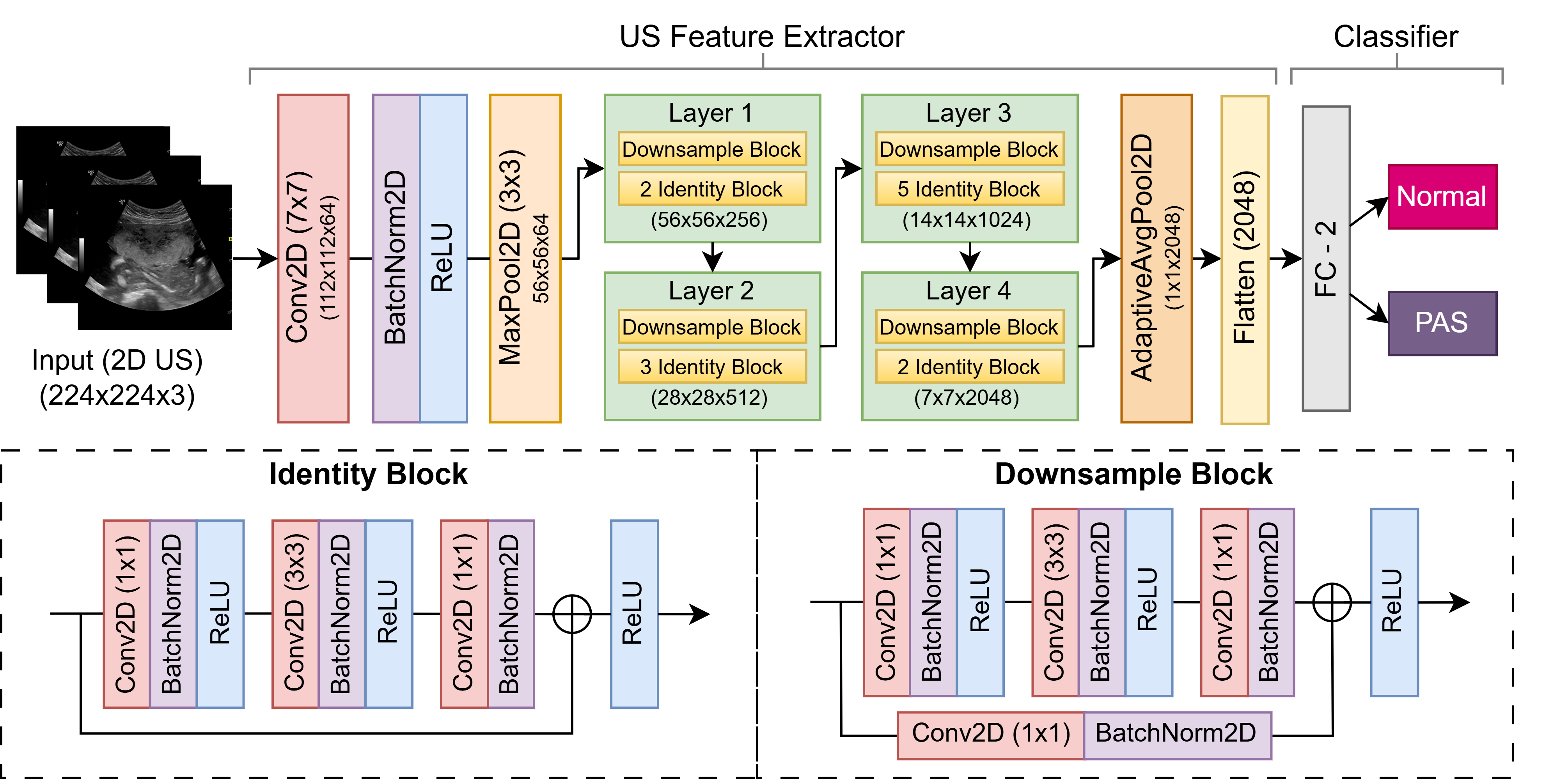 Placenta Accreta Spectrum Detection using Multimodal Deep Learning