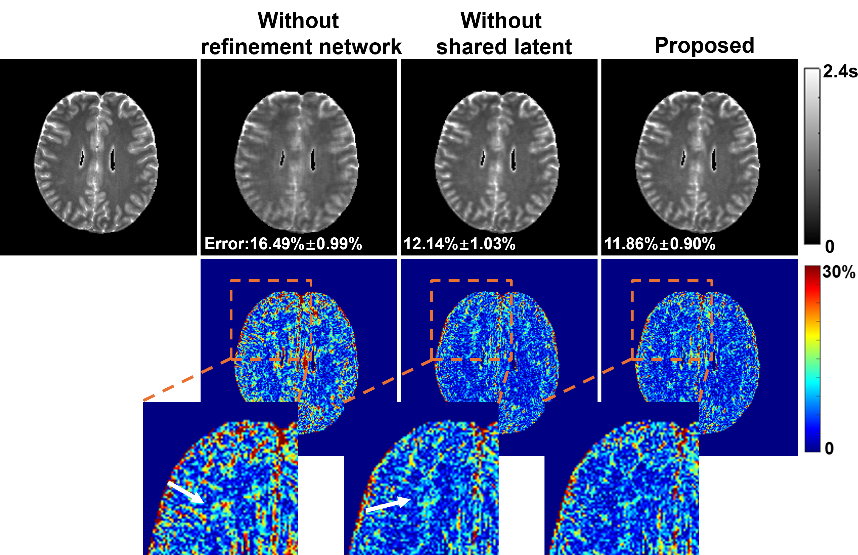 An Adaptive, Disentangled Representation Method for Multidimensional MRI Reconstruction