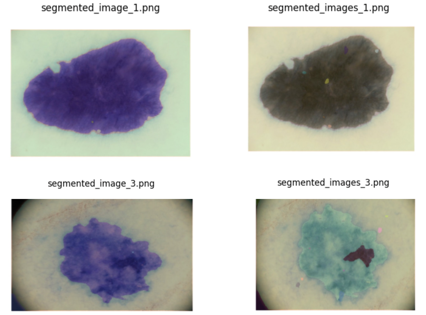 Deep Learning Aids in Skin Disease Diagnosis